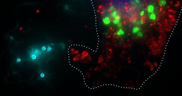 Targeting Advanced Cancers With Bioengineered Salmonella